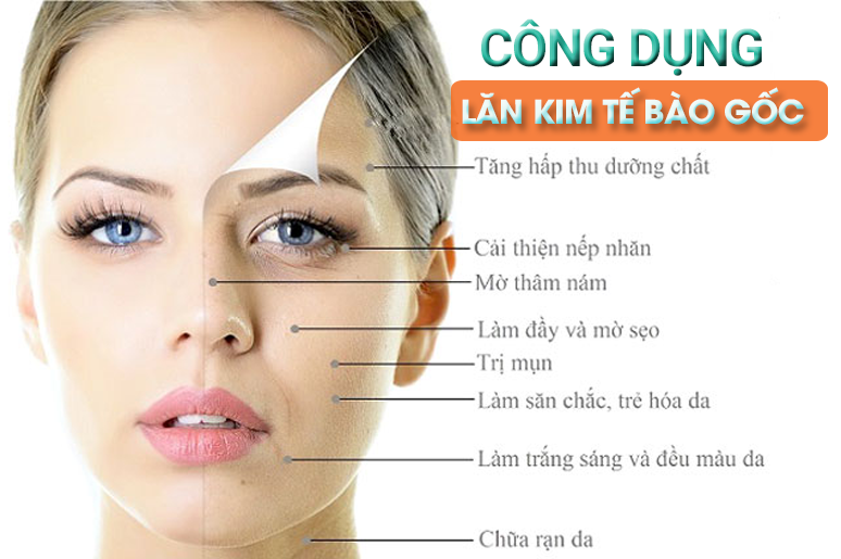 cong-dung-lan-kim-te-bao-goc