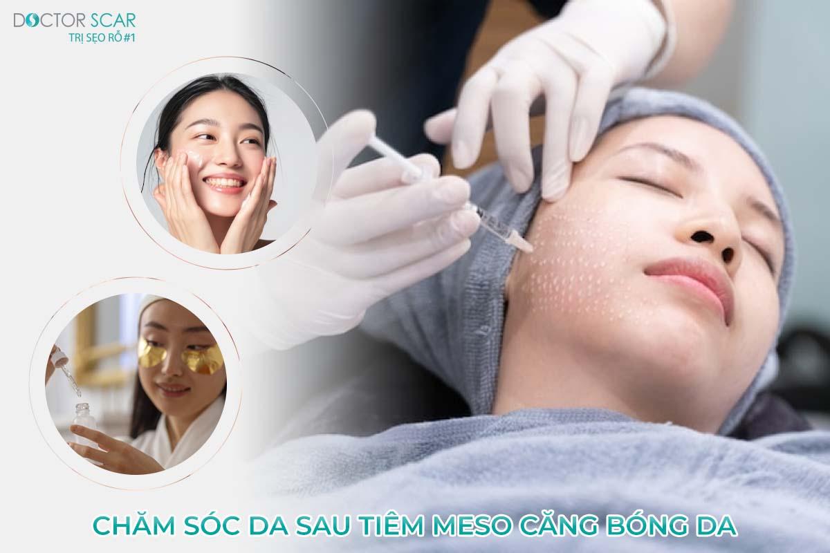 Chăm sóc da sau tiêm meso căng bóng sẽ tăng hiệu quả cải thiện của làn da