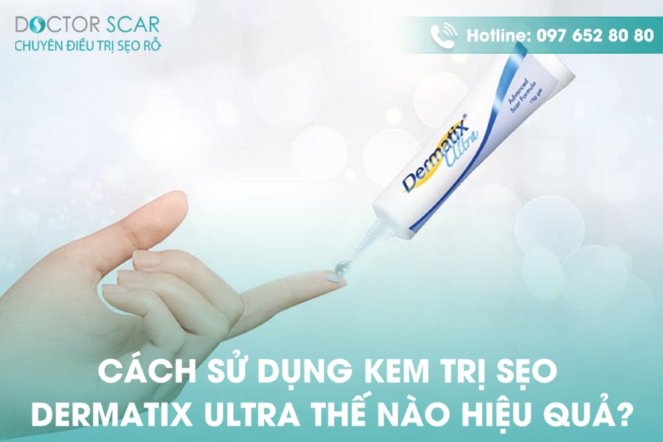 Cách dùng kem dermatix ultra trị sẹo