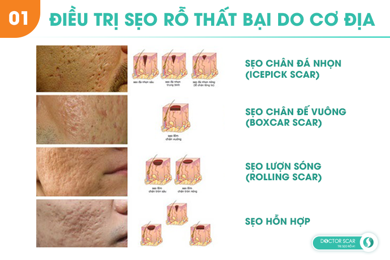 02-6-sai-lam-thuong-gap-khien-ban-tri-seo-ro-that-bai