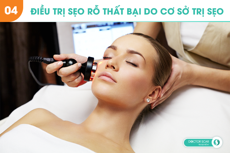 05-6-sai-lam-thuong-gap-khien-ban-tri-seo-ro-that-bai