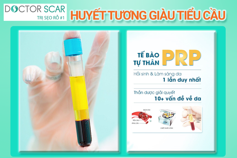 07-phan-loai-seo-ro-seo-lom-va-phuong-phap-dieu-tri-hieu-qua