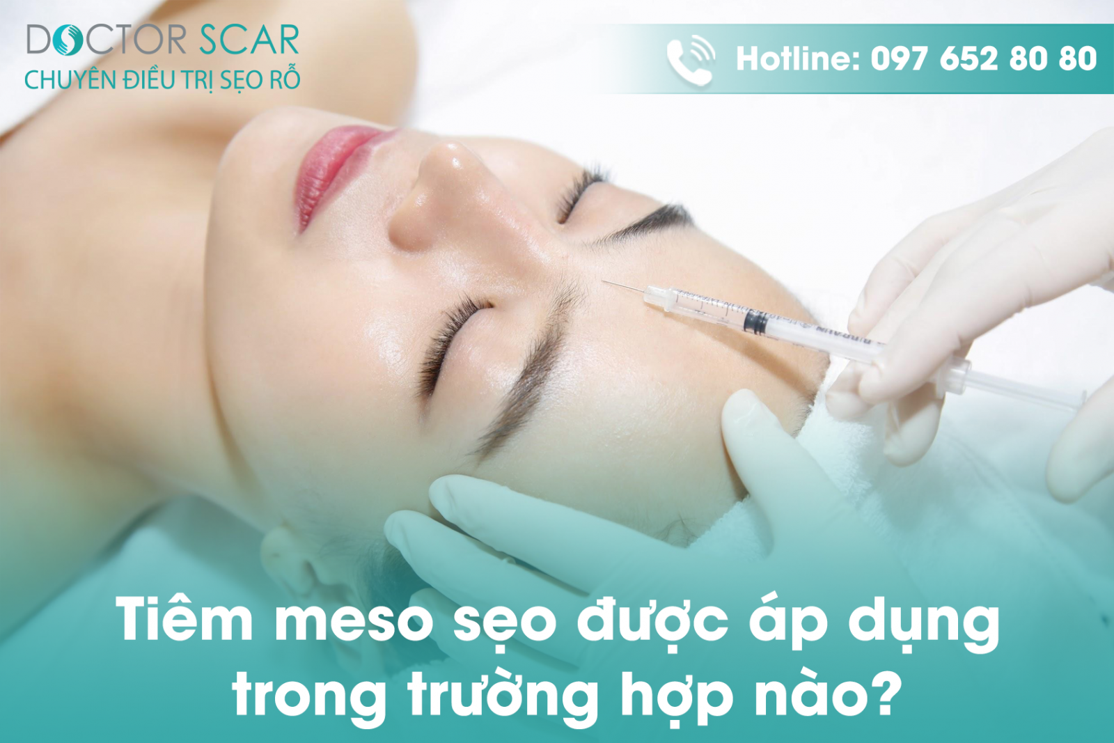 cac truong hop bac si chi  dinh tiem meso