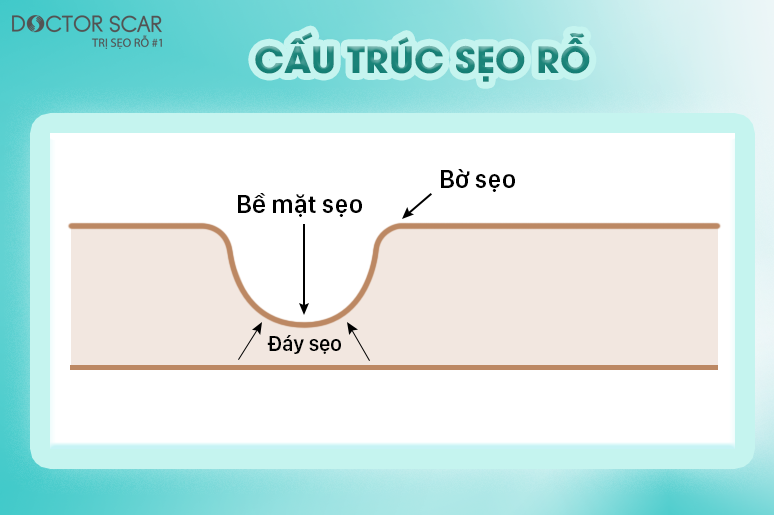 10-seo-co-tai-phat-khong-1