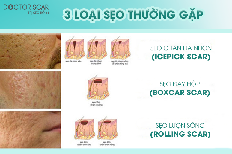 10-seo-co-tai-phat-khong-2