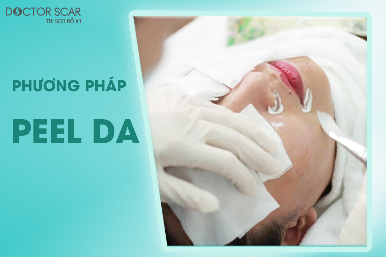 10-seo-co-tai-phat-khong-4