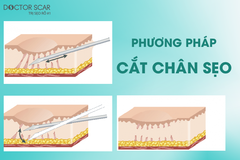 10-seo-co-tai-phat-khong-7