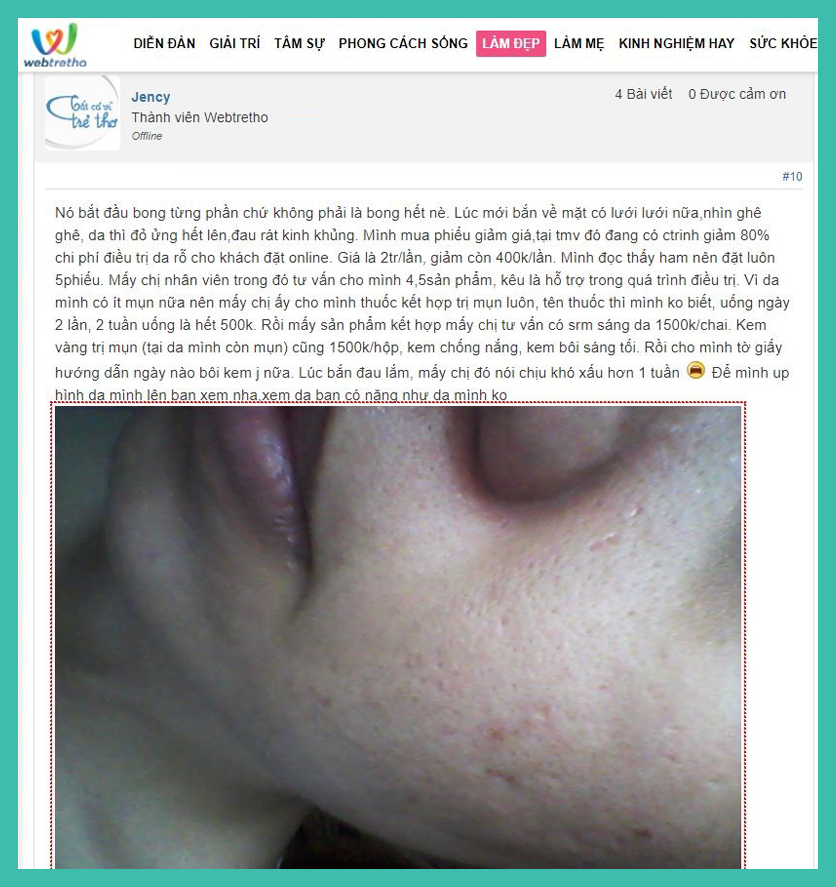 15-Tong-hop-review-dieu-tri-seo-ro-webtretho