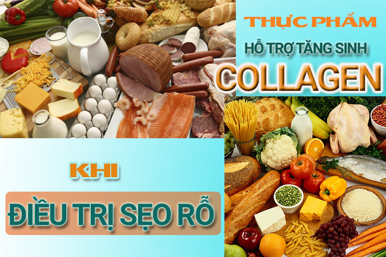 3-cach-ho-tro-qua-trinh-tang-sinh-collagen-khi-dieu-tri-seo-ro-3