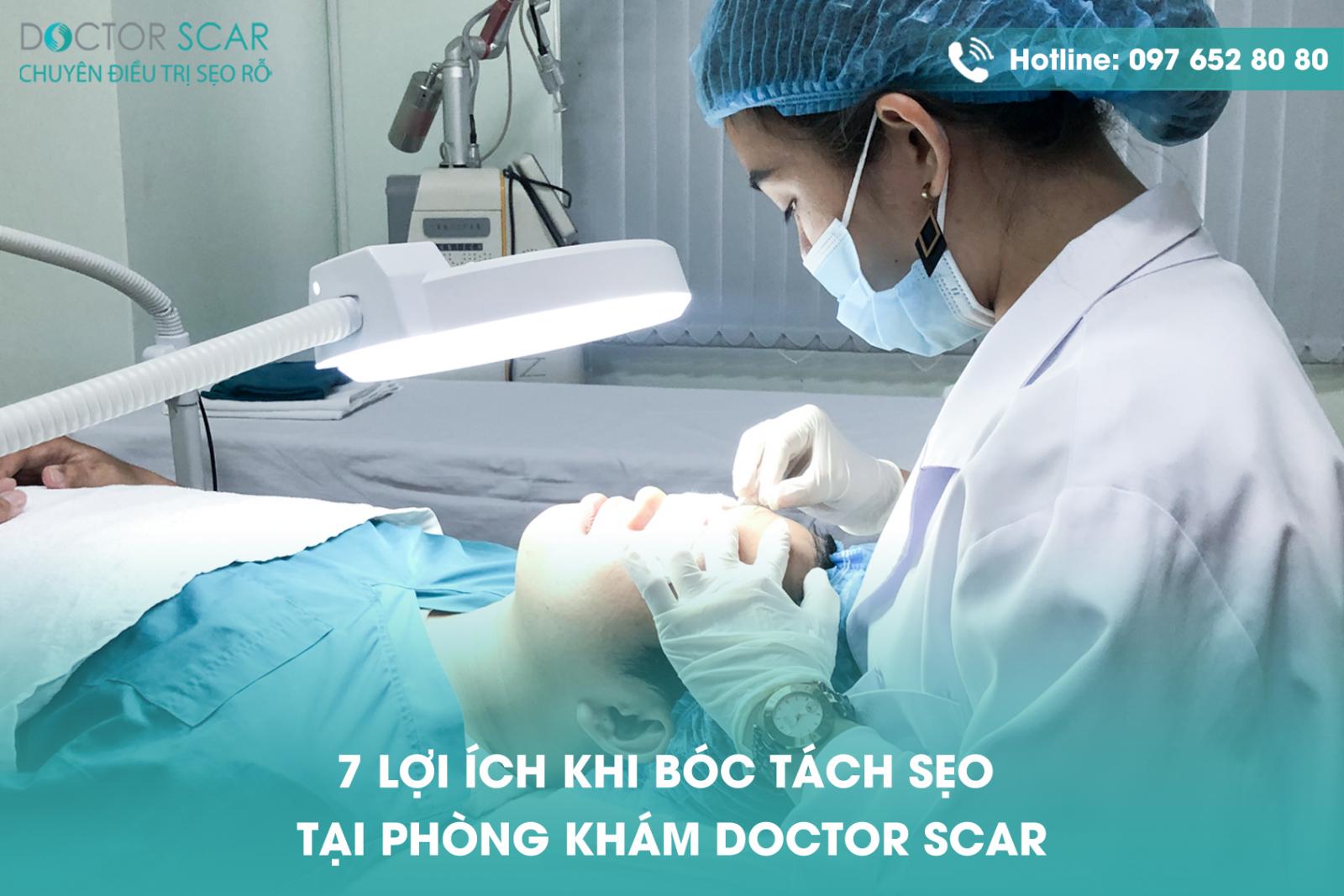 7 Lợi ích khi bóc tách sẹo tại phòng khám Doctor Scar