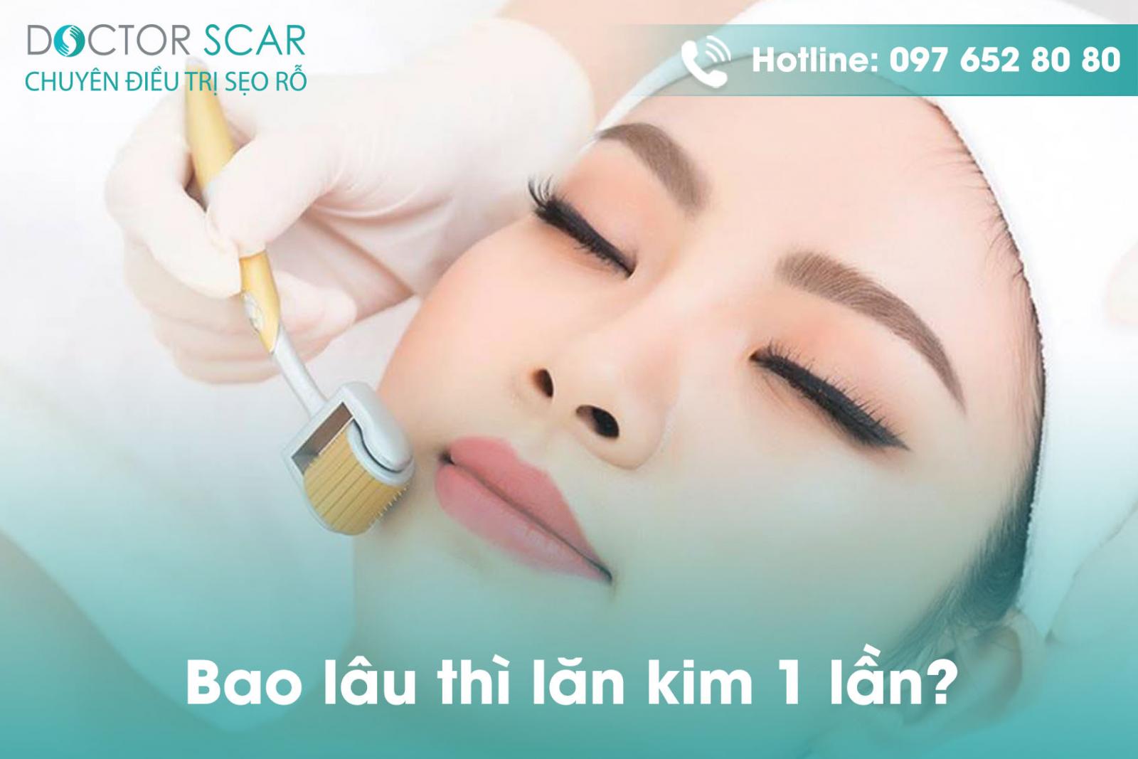 Bao lâu thì lăn kim 1 lần?