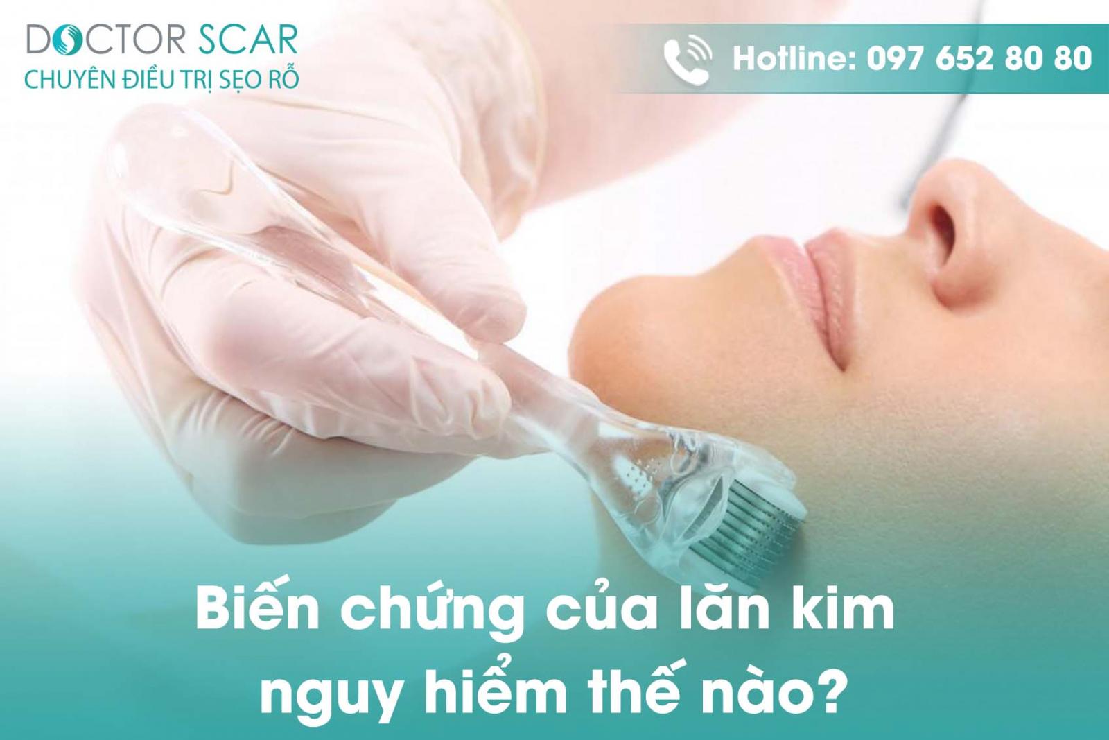 Biến chứng của lăn kim nguy hiểm thế nào?