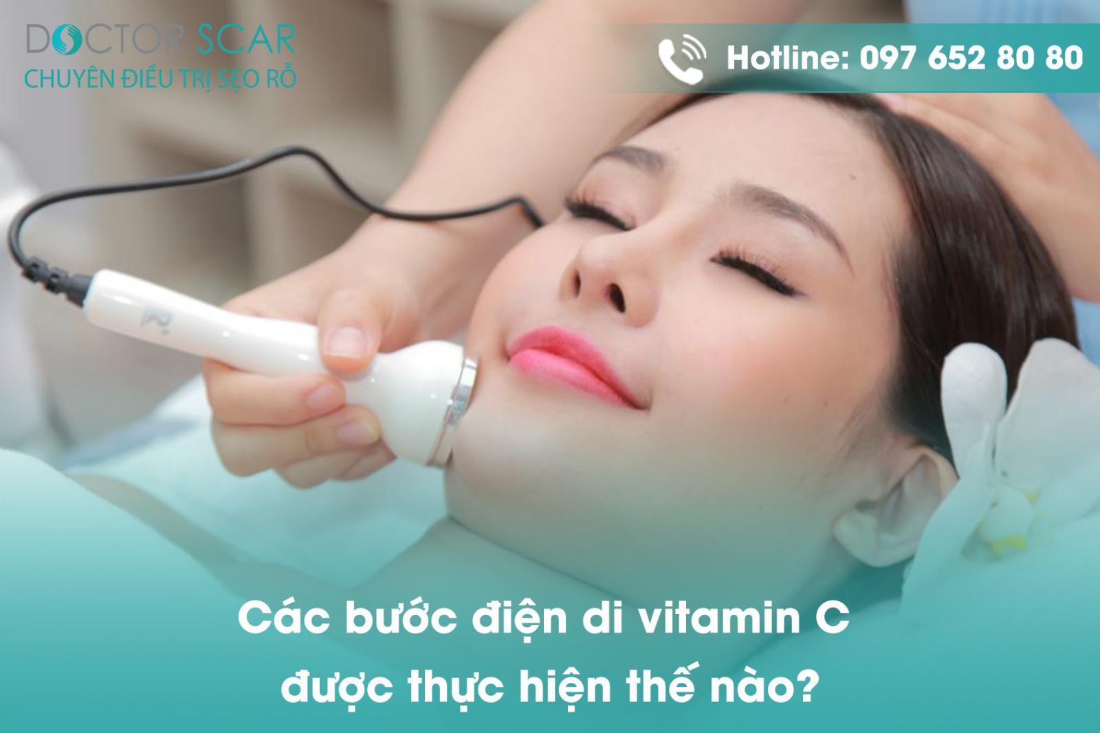 Các bước điện di vitamin C được thực hiện thế nào?