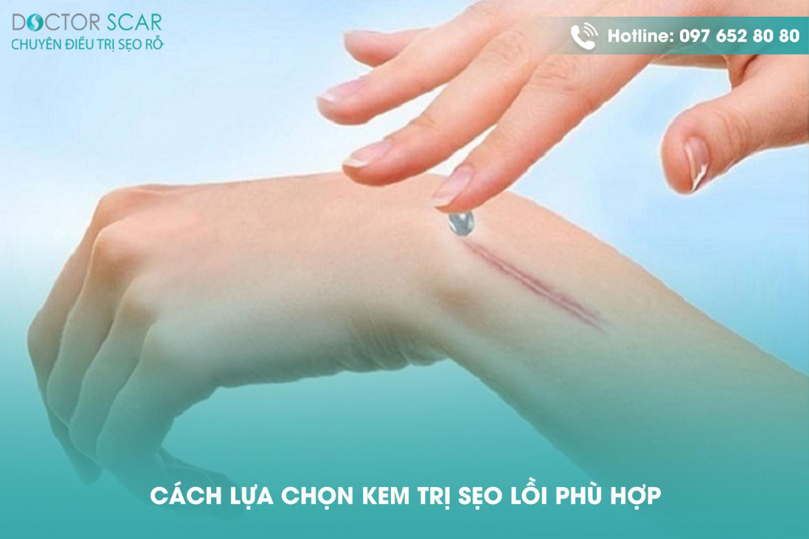 Cách lựa chọn kem trị sẹo lồi phù hợp