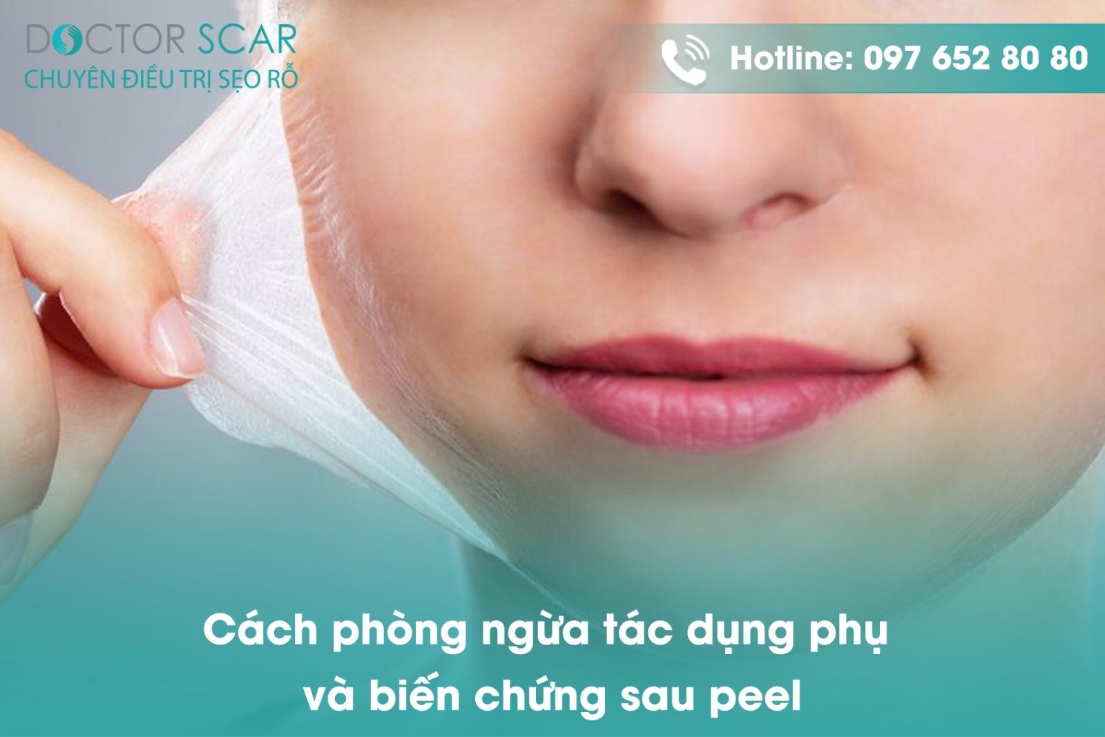 Cách phòng ngừa tác dụng phụ và biến chứng sau peel