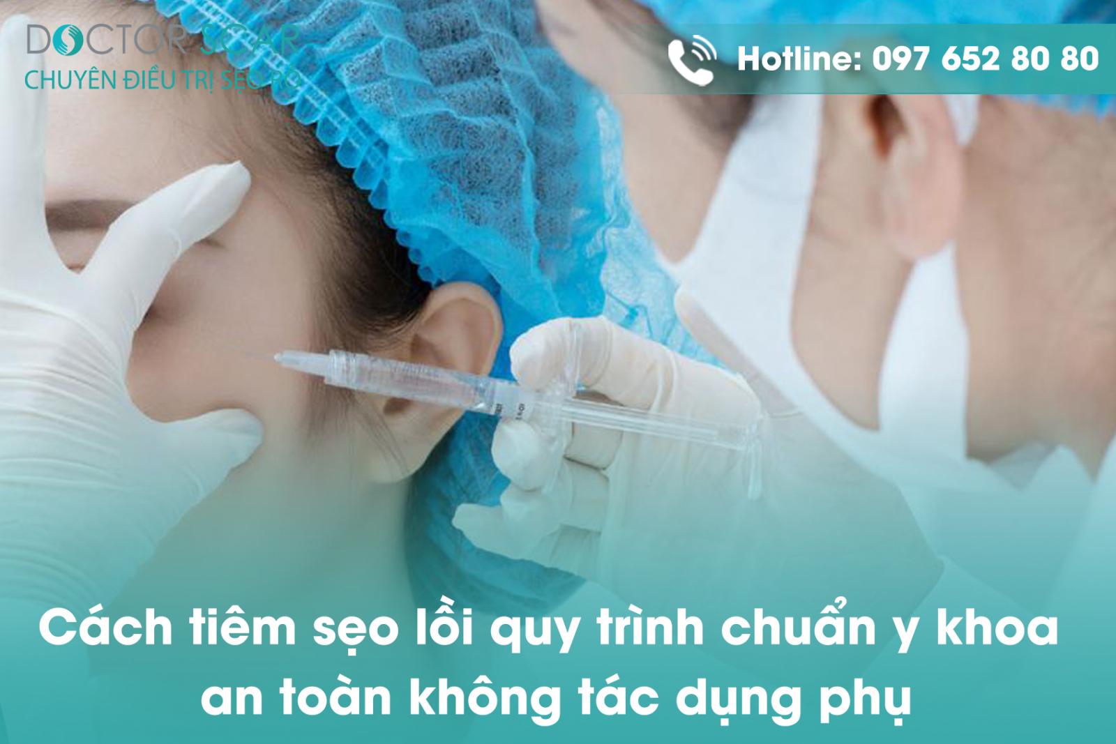 Cách tiêm sẹo lồi quy trình chuẩn y khoa an toàn không tác dụng phụ