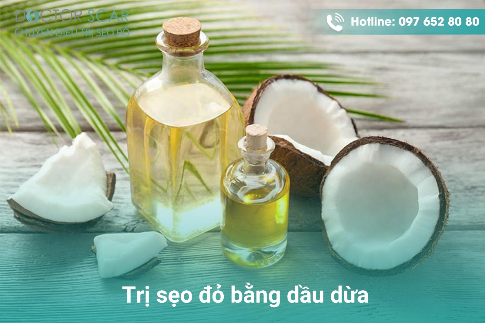 Trị sẹo đỏ bằng dầu dừa.