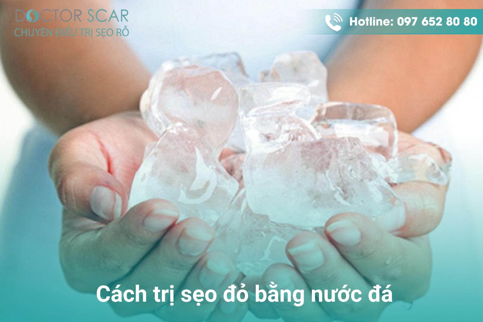 Cách trị sẹo đỏ bằng nước đá.