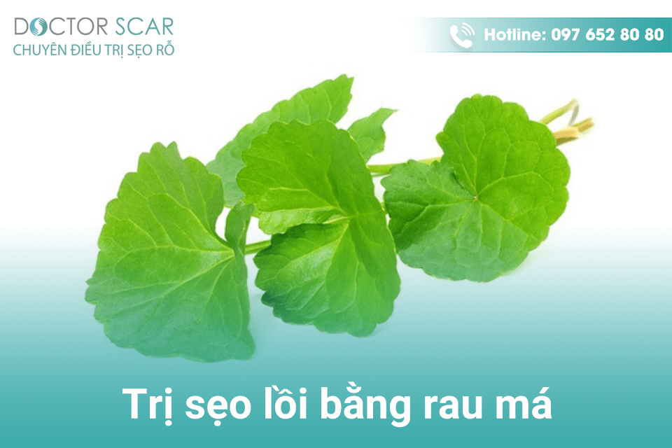 Cách trị sẹo lồi bằng rau má