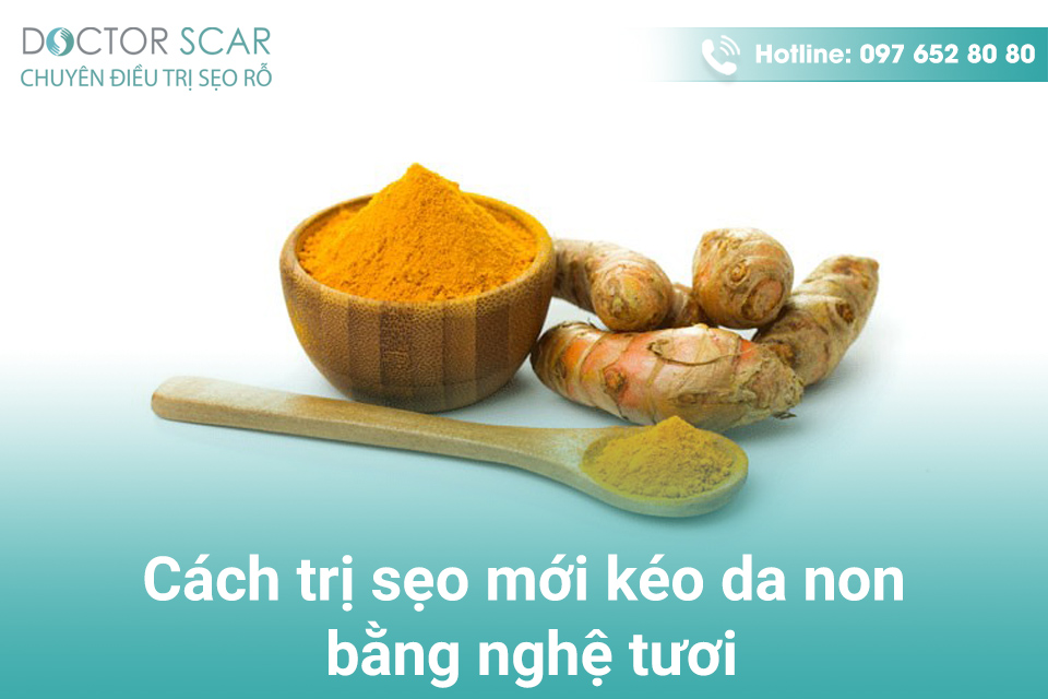 Cách trị sẹo mới kéo da non bằng nghệ tươi.