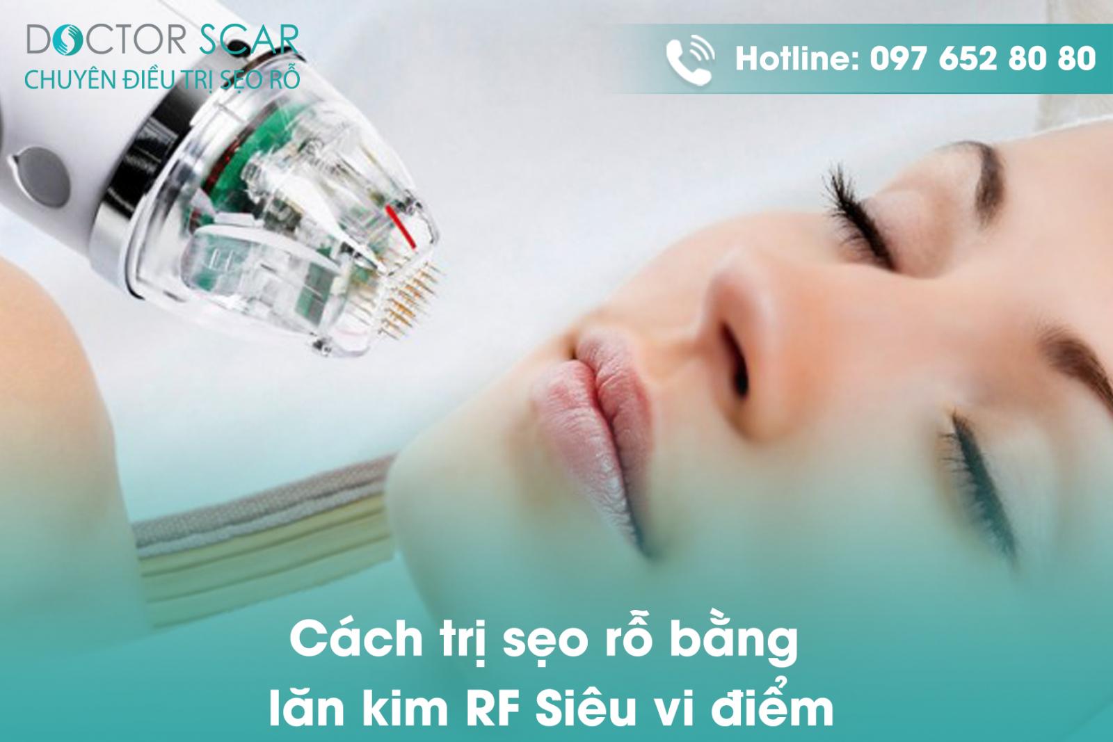 Cách trị sẹo rỗ lỗ chân lông to bằng lăn kim RF Siêu vi điểm