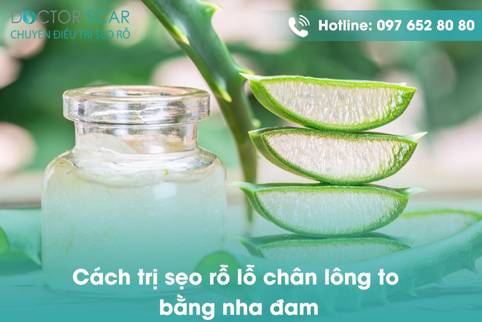 Cách trị sẹo rỗ lỗ chân lông to bằng nha đam