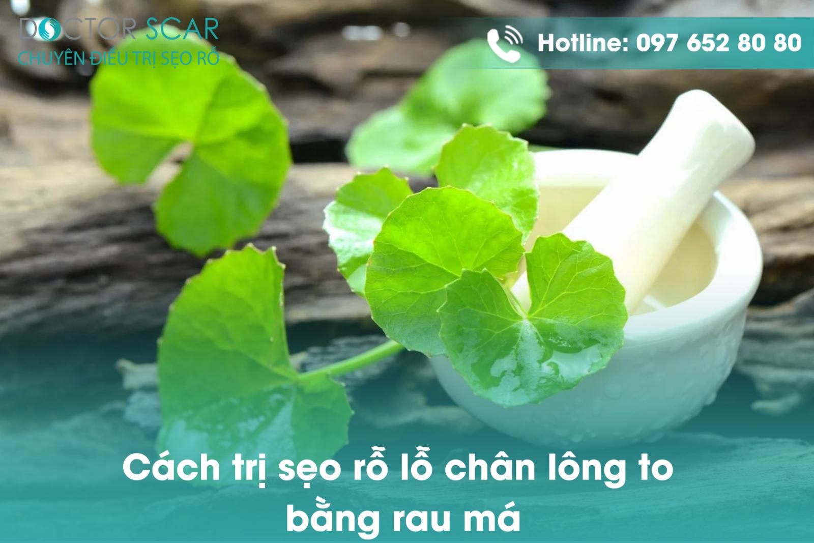 Cách trị sẹo rỗ lỗ chân lông to bằng rau má