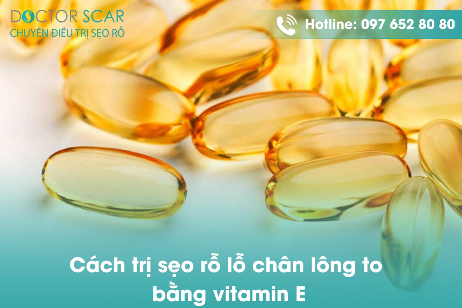 Cách trị sẹo rỗ lỗ chân lông to bằng vitamin E