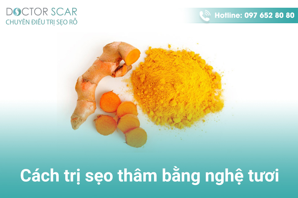 Cách trị sẹo trên mặt bằng nghệ tươi.