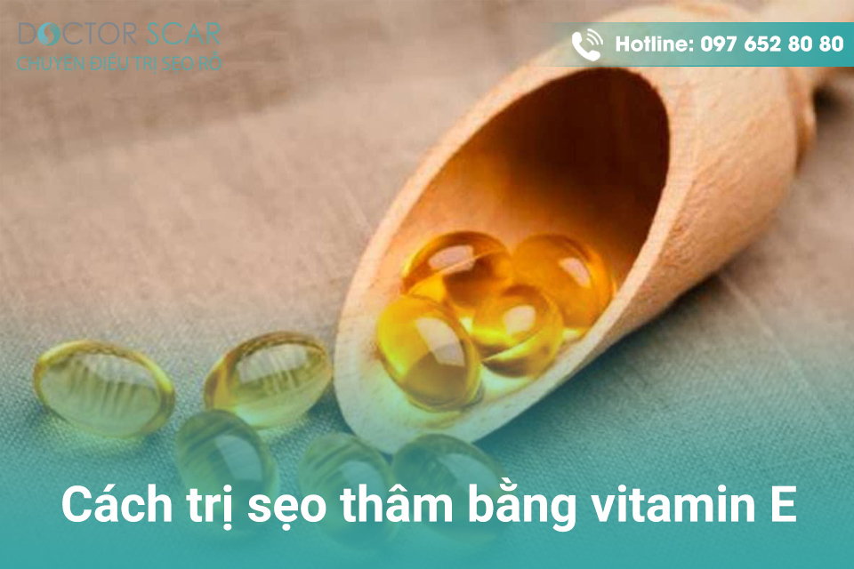 Cách trị sẹo trên mặt bằng vitamin E.