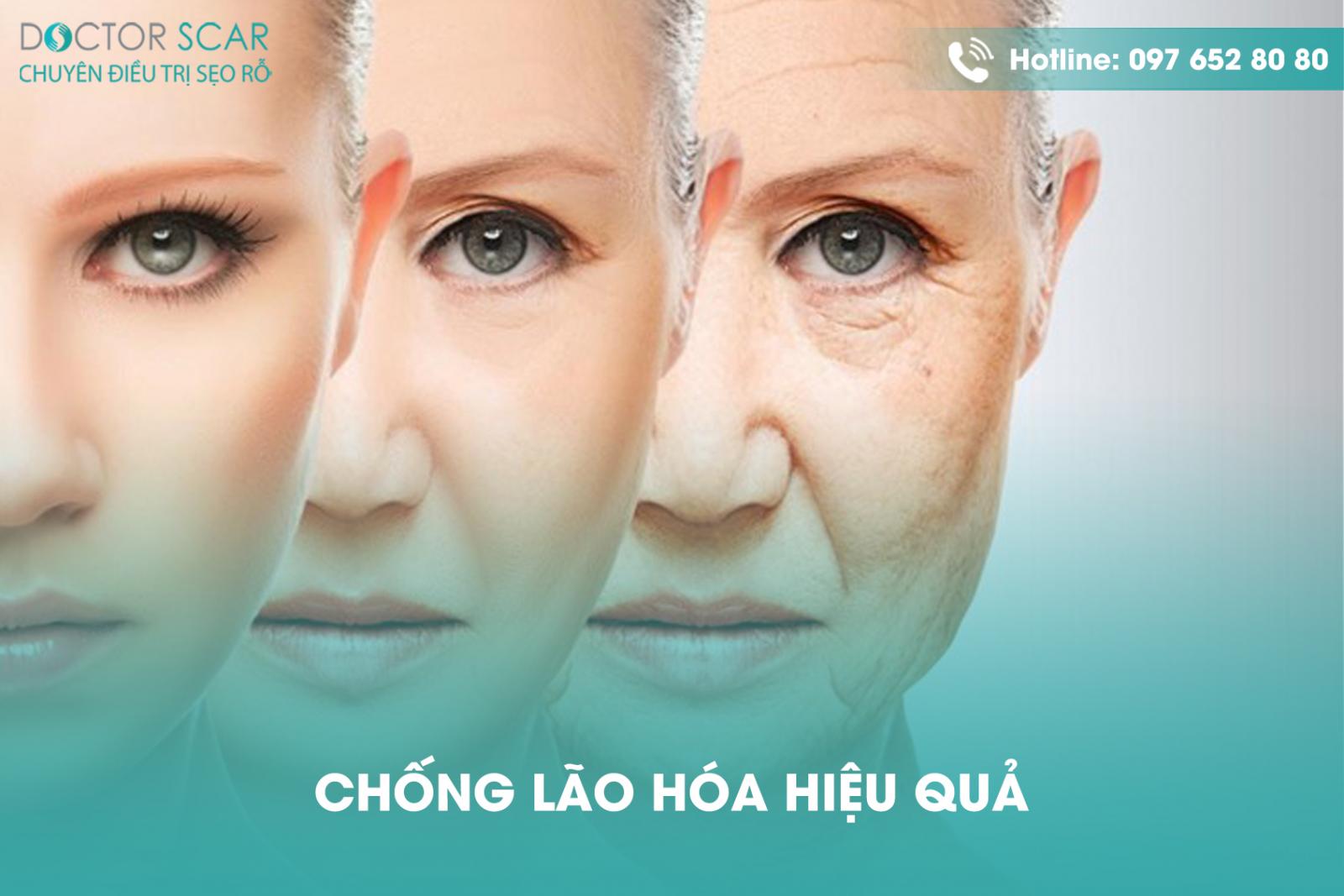 Chống lão hóa hiệu quả