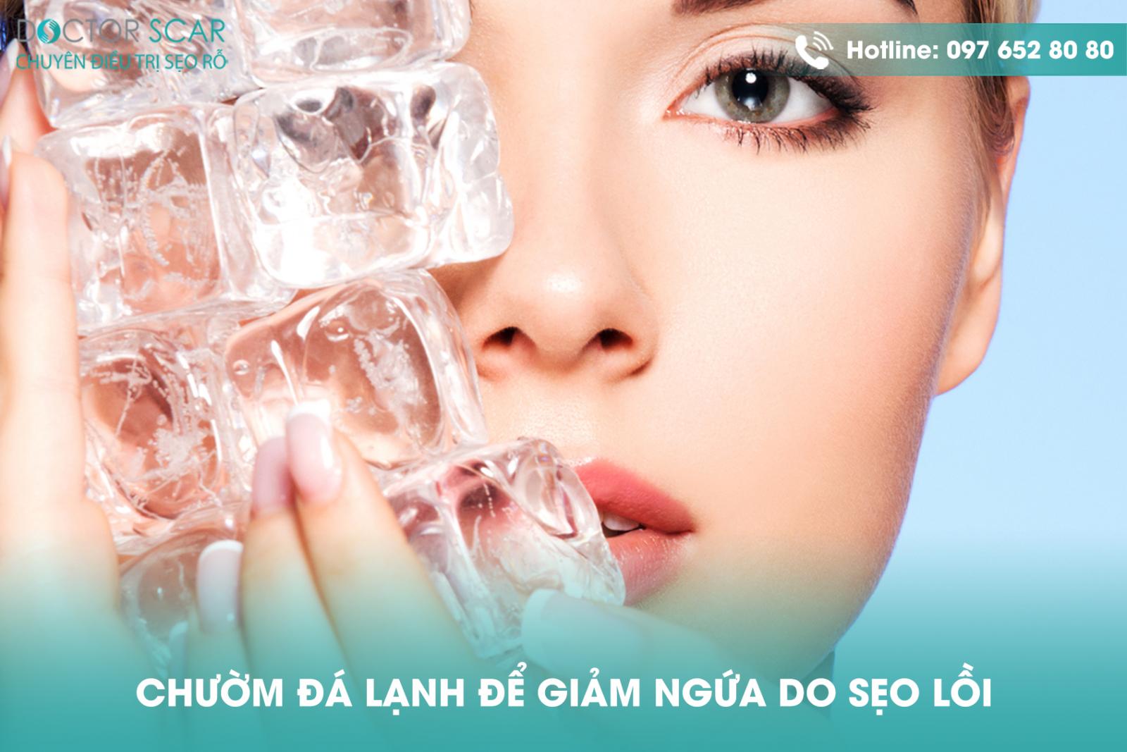 Chườm đá lạnh để giảm ngứa do sẹo lồi