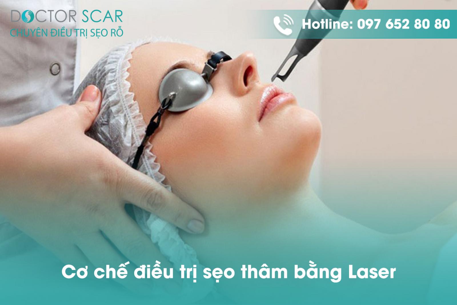 Cơ chế điều trị sẹo thâm bằng Laser.