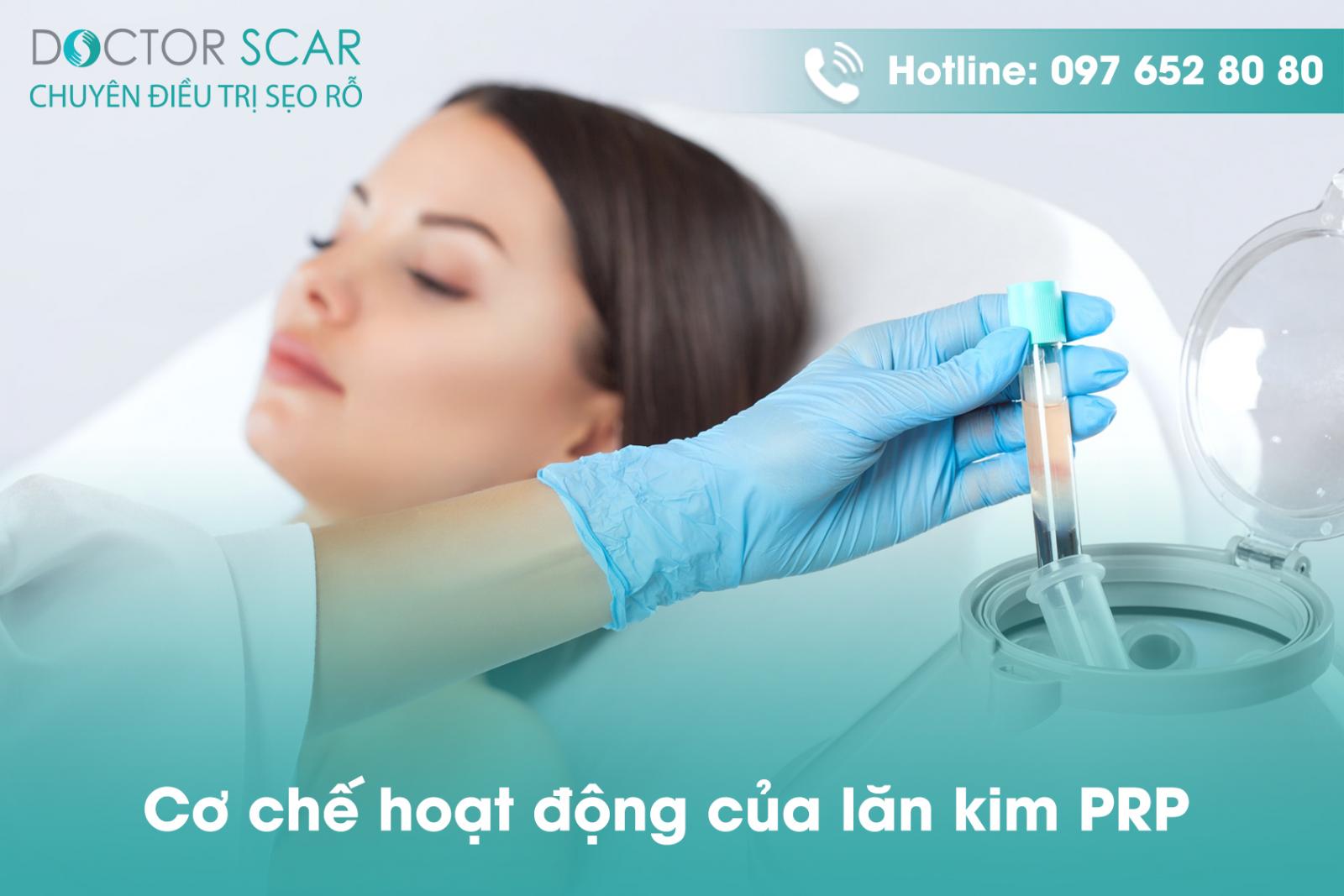 Cơ chế hoạt động của lăn kim prp