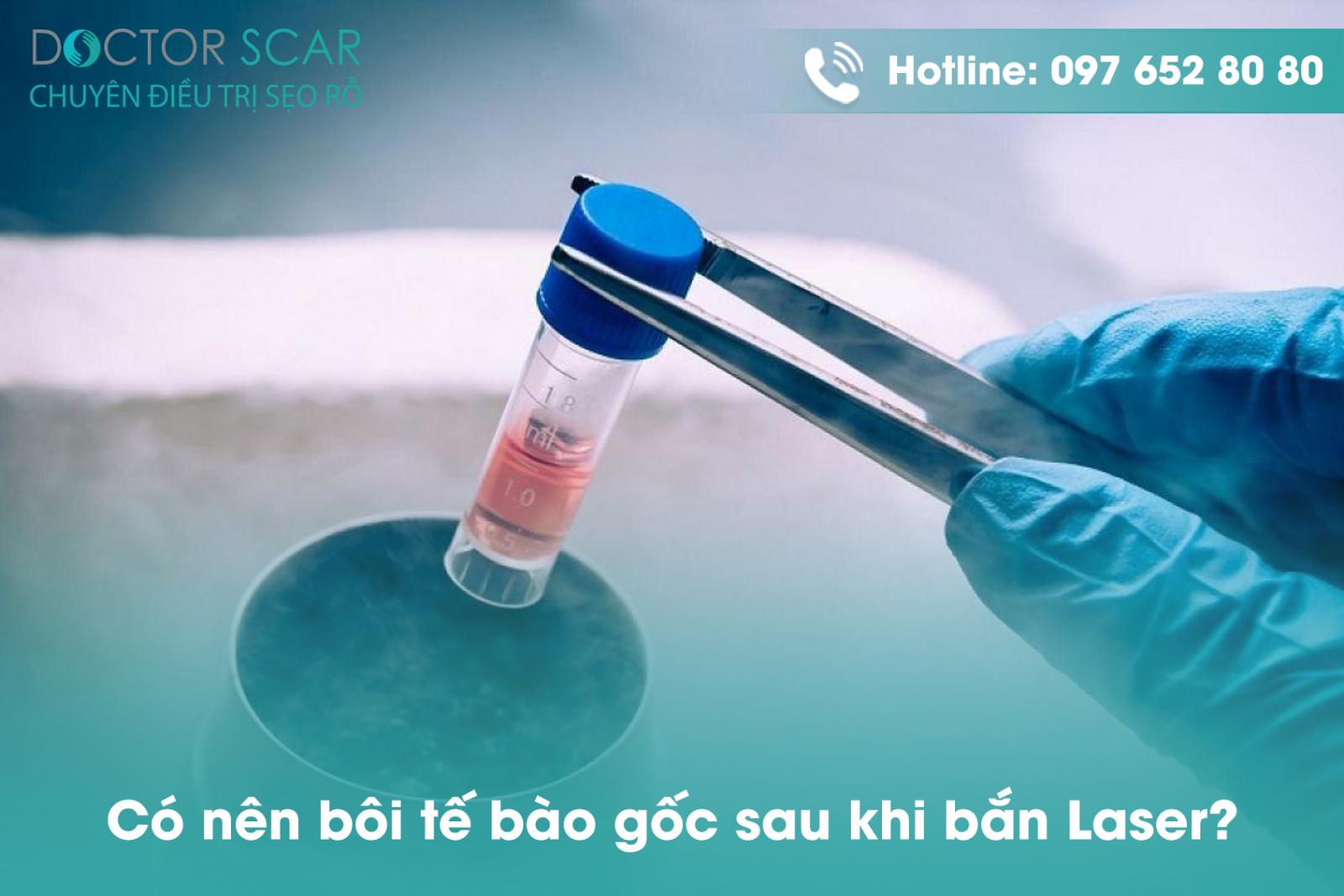 Có nên bôi tế bào gốc sau khi bắn laser?