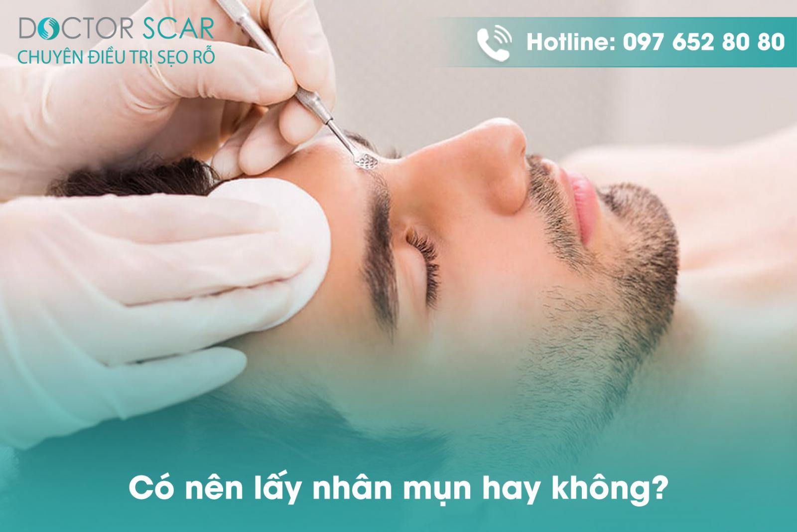 Có nên lấy nhân mụn hay không?