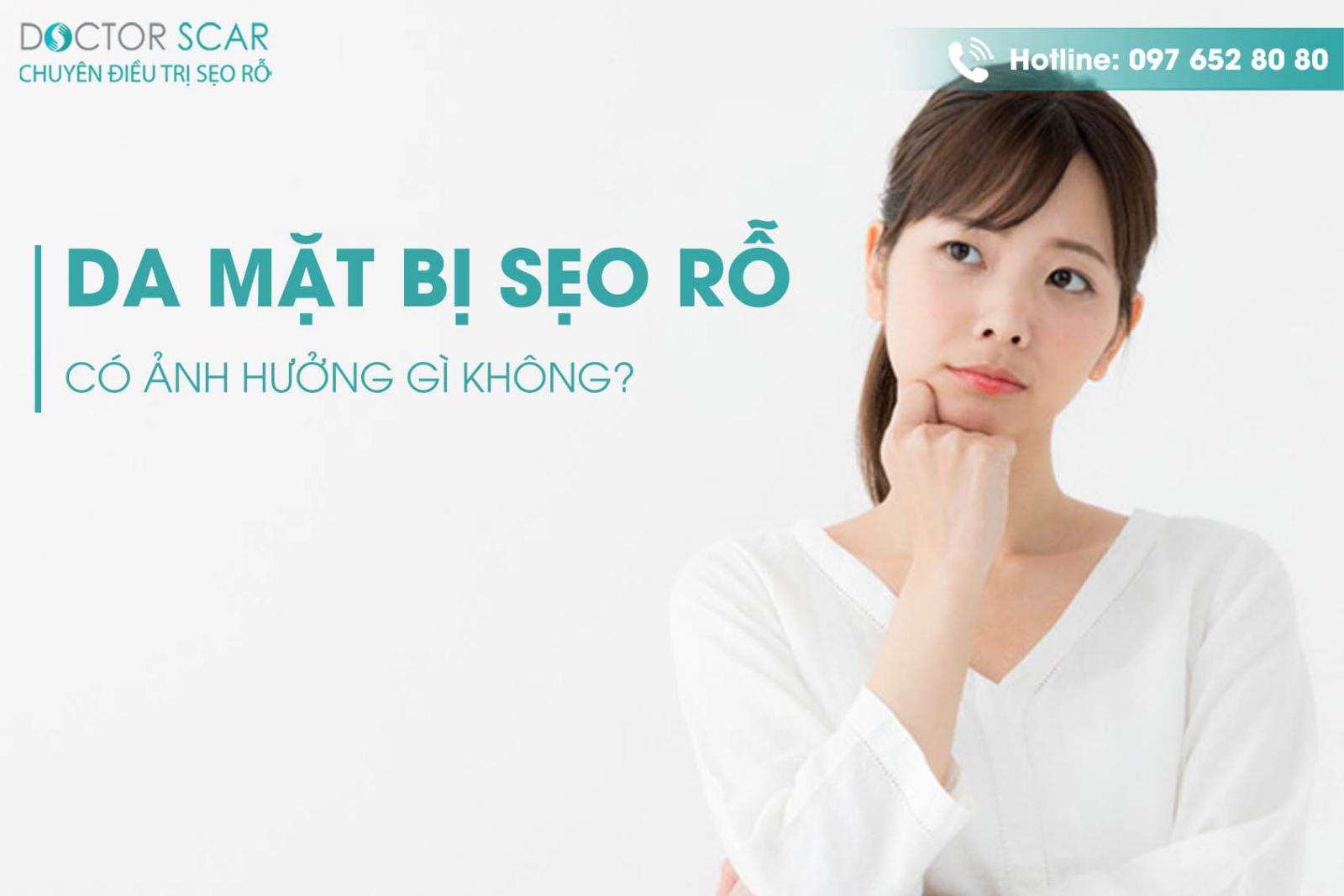 Da mặt bị sẹo rỗ có ảnh hưởng gì không?