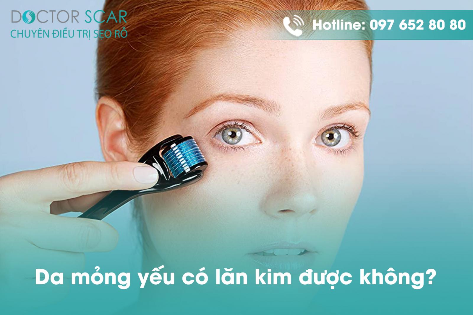 Da mỏng yếu có lăn kim được không?