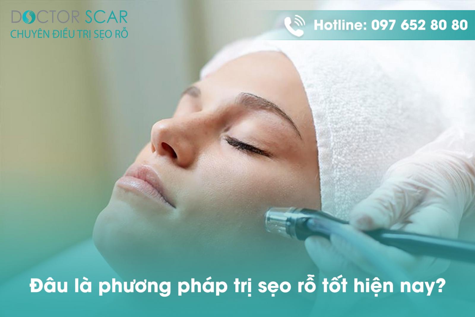 Đâu là phương pháp trị sẹo rỗ tốt hiện nay?