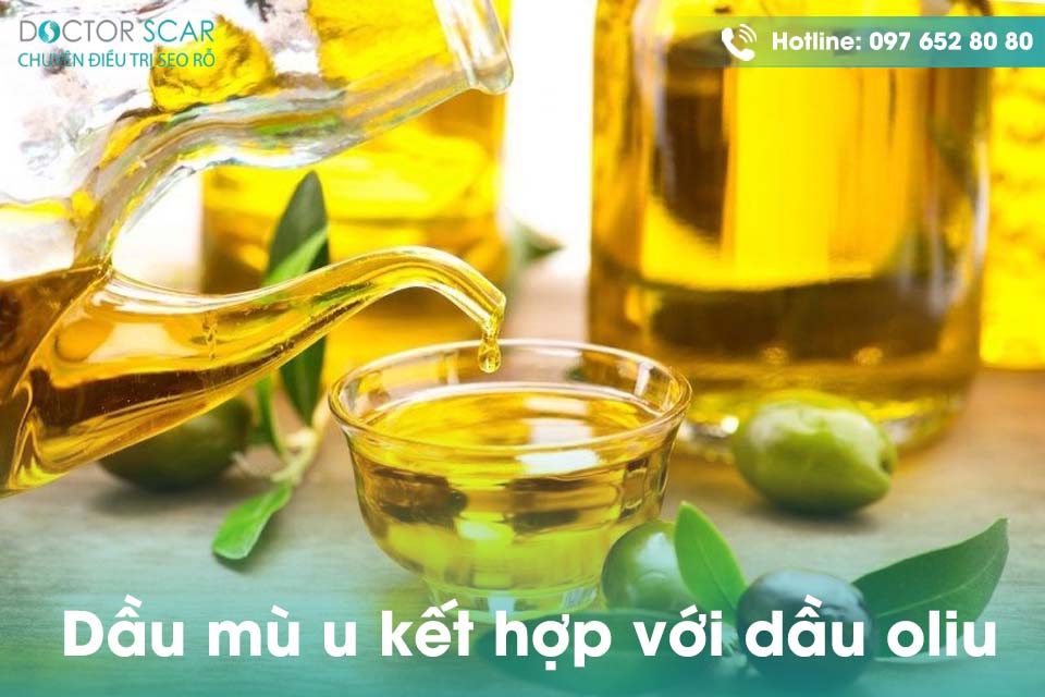 Dầu mu u kết hợp với dầu oliu điều trị sẹo.