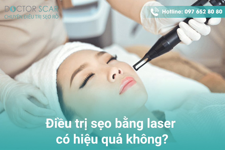 Điều trị sẹo bằng laser có hiệu quả không?