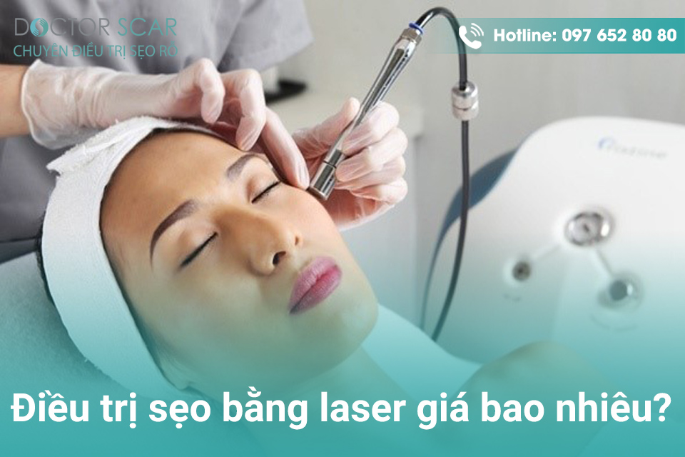 Trị sẹo bằng laser giá bao nhiêu?