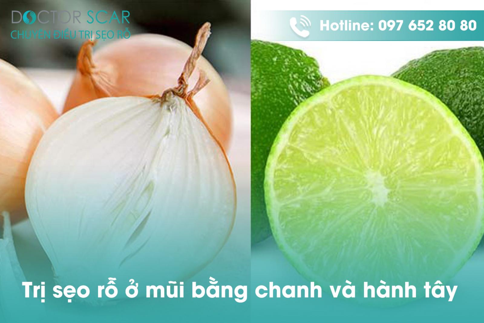 Điều trị sẹo rỗ ở mũi bằng chanh và hành tây