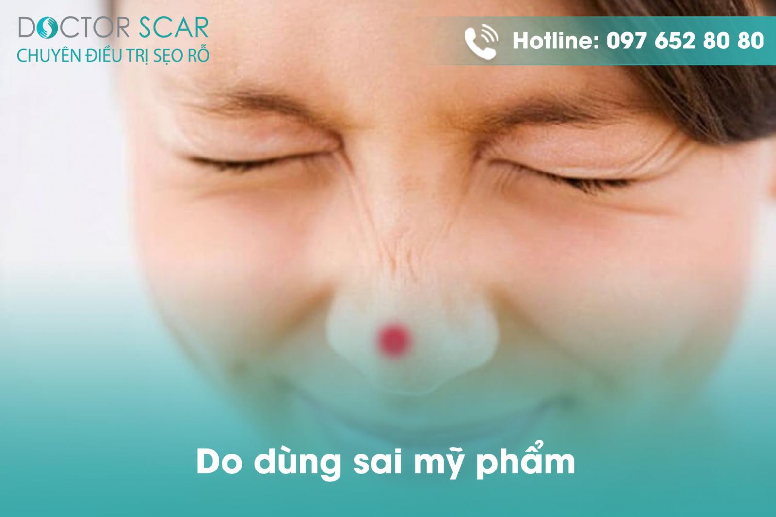 Do dùng sai mỹ phẩm.