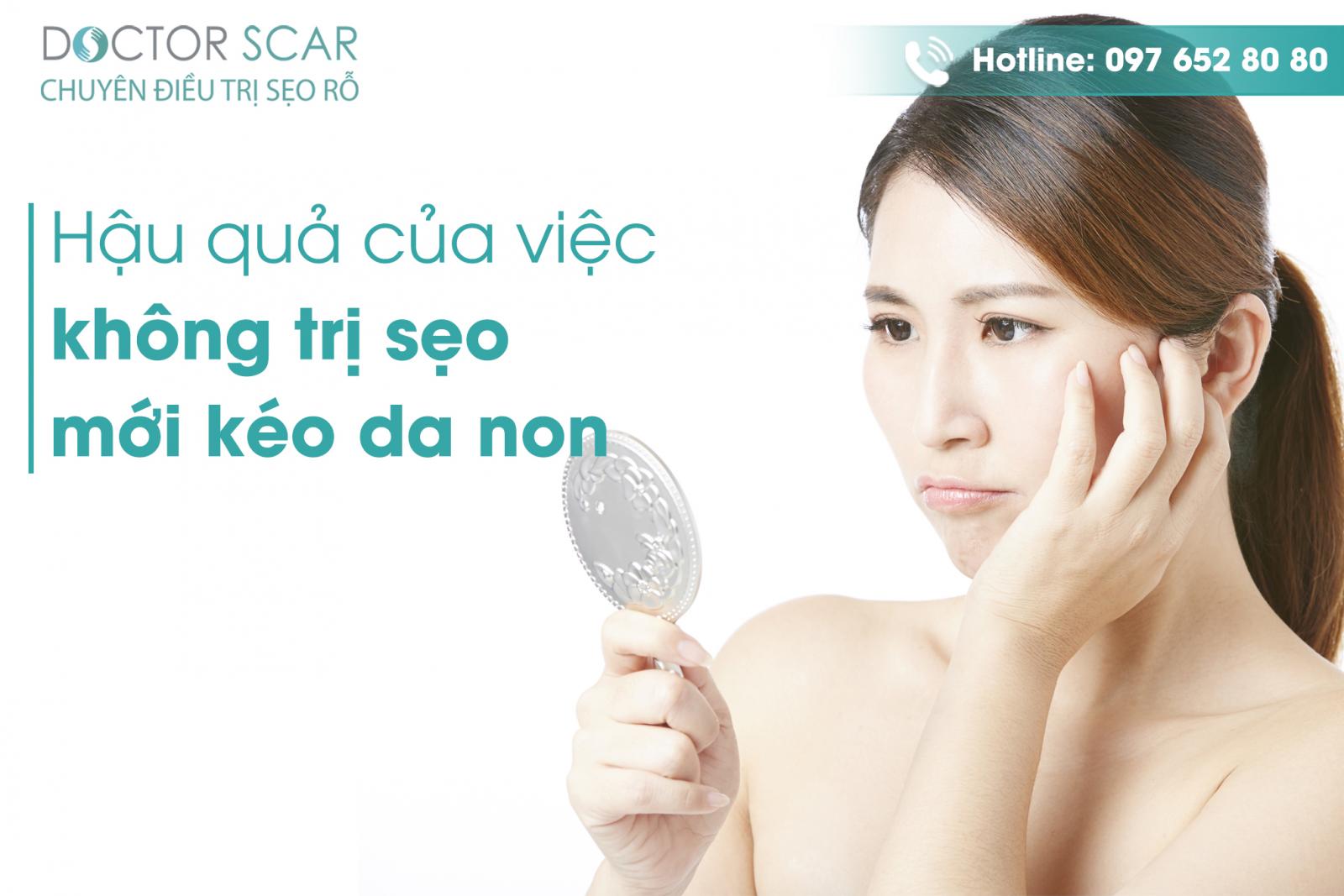 Hậu quả của việc không trị sẹo mới kéo da non