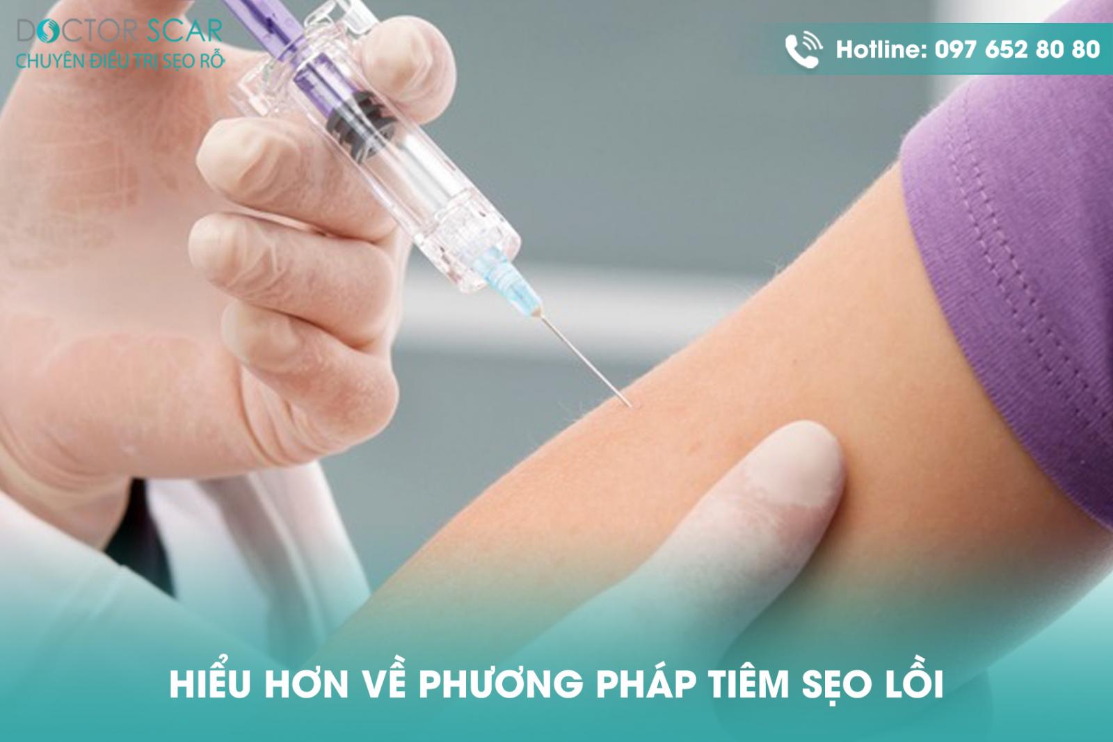 Hiểu hơn về phương pháp tiêm sẹo lồi