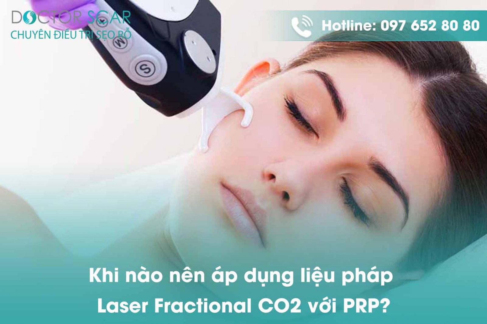 Khi nào nên áp dụng liệu pháp Laser Fractional CO2 với PRP?