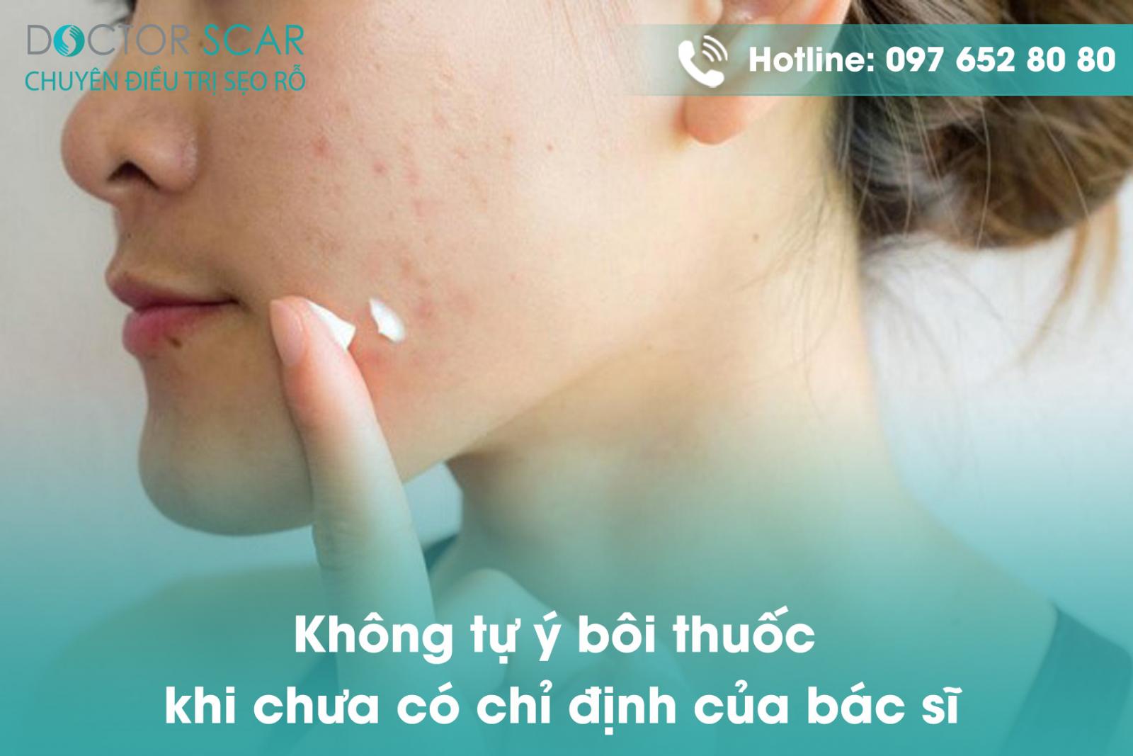 Không tự ý bôi thuốc khi chưa có chỉ định của bác sĩ