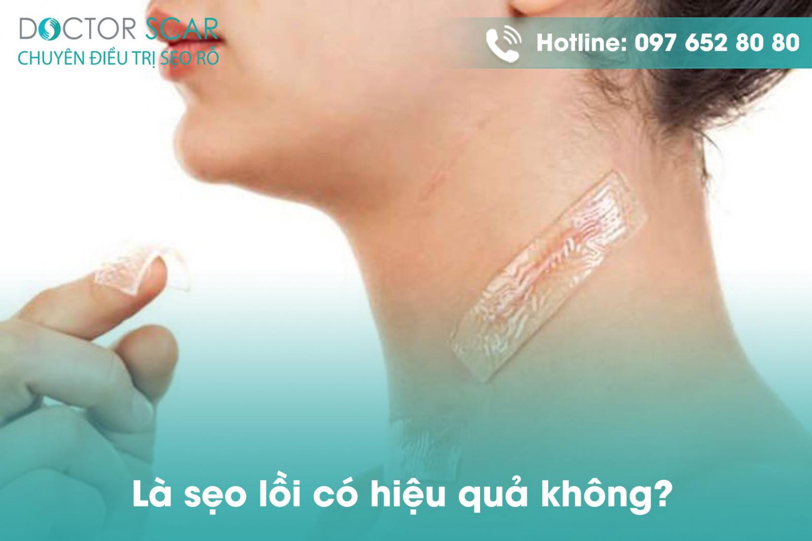 Là sẹo lồi có hiệu quả không?