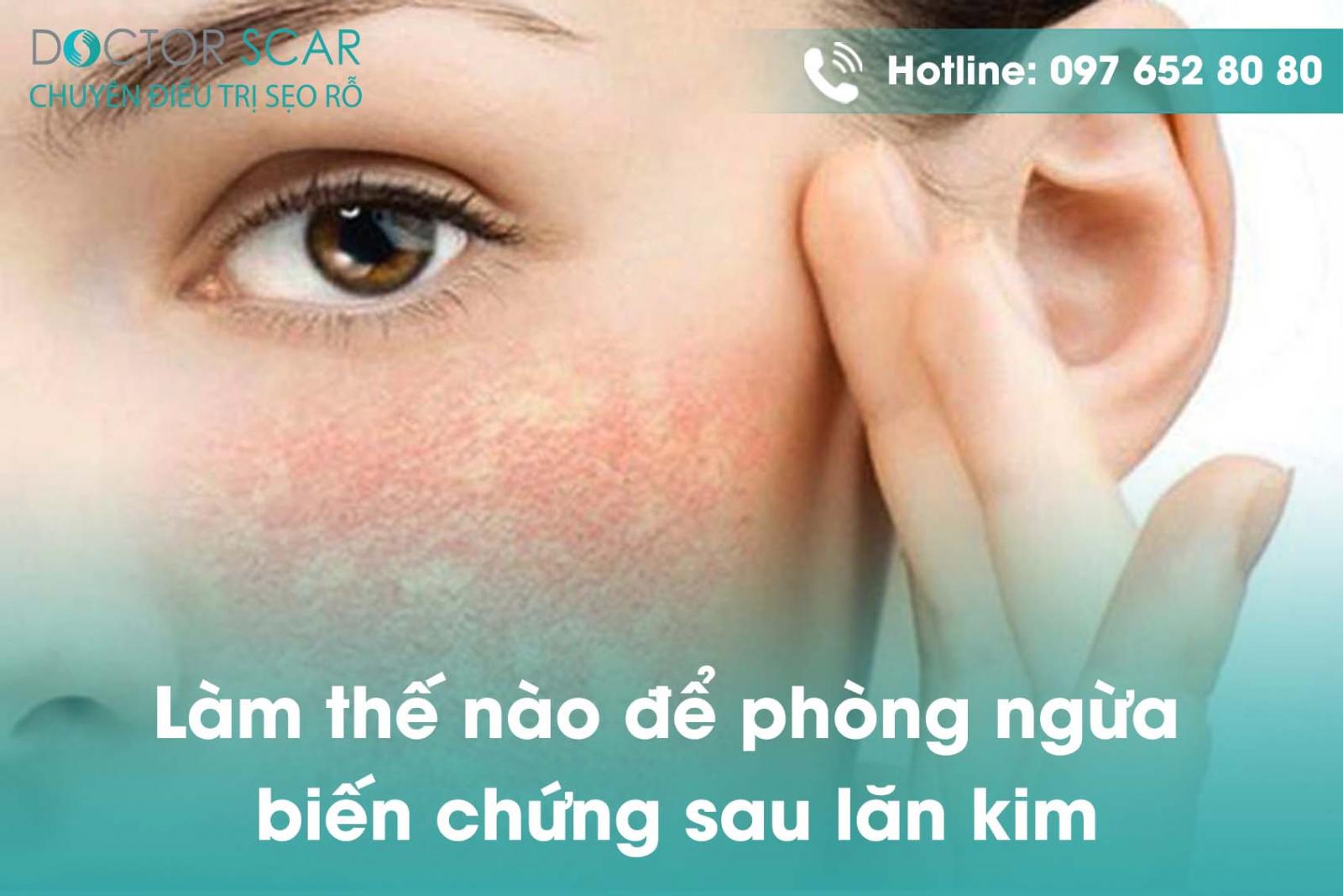 Làm thế nào để phòng ngừa biến chứng sau lăn kim?